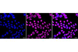 Immunocytochemical staining of HepG2 cells with Histone H4 (acetyl K5) antibody (ABIN7798979), 1:1,000).