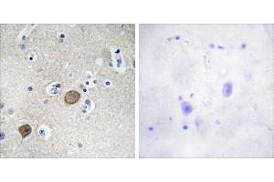 Peptide - +Immunohistochemistry analysis of paraffin-embedded human brain tissue using Catenin-α1 antibody. (CTNNA1 antibody  (Internal Region))