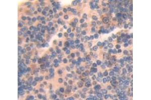 Figure. (CRLF1 antibody  (AA 138-422))