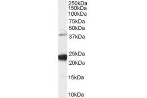 Western Blotting (WB) image for anti-GIPC PDZ Domain Containing Family, Member 1 (GIPC1) (C-Term) antibody (ABIN2465223) (GIPC1 antibody  (C-Term))