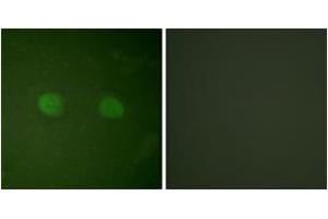 Immunofluorescence analysis of HeLa cells, using PPAR-alpha (Ab-21) Antibody.