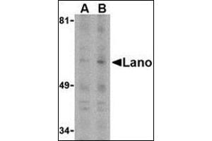 Western blot analysis of Lano in PC-3 whole cell lysate with this product at (A) 1 or (B) 2 μg /ml. (LRRC1 antibody  (C-Term))