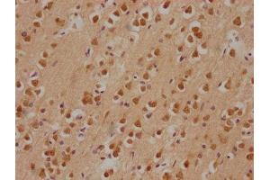 IHC image of ABIN7146598 diluted at 1:200 and staining in paraffin-embedded human brain tissue performed on a Leica BondTM system. (PRKACA antibody  (Catalytic Subunit alpha))
