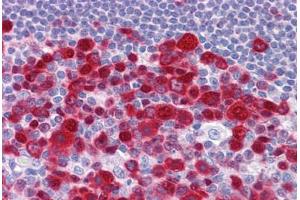 Human Tonsil: Formalin-Fixed, Paraffin-Embedded (FFPE) (Deoxyuridine Triphosphatase (DUT) (AA 68-164) antibody)