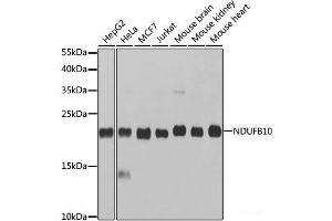 Western blot analysis of extracts of various cell lines using NDUFB10 Polyclonal Antibody at dilution of 1:1000.