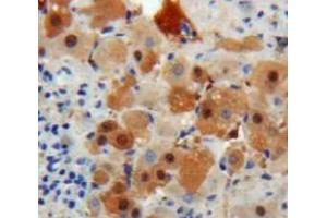 IHC-P analysis of Liver tissue, with DAB staining. (TTR antibody  (AA 21-147))