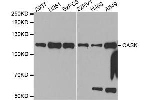 Western blot analysis of extracts of various cell lines, using CASK antibody (ABIN5971336) at 1/1000 dilution. (CASK antibody)