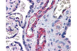 Immunohistochemistry (IHC) image for anti-SUZ12 Polycomb Repressive Complex 2 Subunit (SUZ12) (Middle Region) antibody (ABIN2779689) (SUZ12 antibody  (Middle Region))