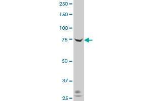 ADAM20 polyclonal antibody (A01), Lot # 060613JCS1 Western Blot analysis of ADAM20 expression in Hela S3 NE . (ADAM20 antibody  (AA 268-358))