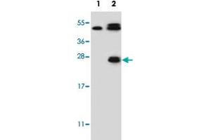 Western blot analysis of KLK6 (arrow) using KLK6 polyclonal antibody . (Kallikrein 6 antibody  (Internal Region))