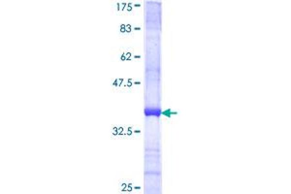 TM9SF2 Protein (AA 116-215) (GST tag)