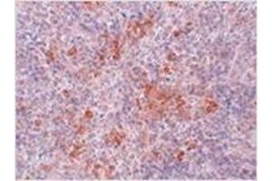 Immunohistochemistry (Paraffin-embedded Sections) (IHC (p)) image for anti-Angiotensin II Receptor, Type 1 (AGTR1) (Center) antibody (ABIN783580)