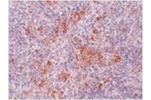 Immunohistochemistry of AGTR1 in mouse kidney tissue with AGTR1 antibody at 2. (Angiotensin II Type-1 Receptor antibody  (Center))