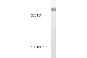 dilution: 1 : 1000, sample: rat brain homogenate (MAP2 antibody  (AA 2-309))