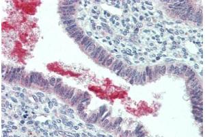 Human Uterus (formalin-fixed, paraffin-embedded) stained with GRN antibody ABIN396952 at 5 ug/ml followed by biotinylated goat anti-rabbit IgG secondary antibody ABIN481713, alkaline phosphatase-streptavidin and chromogen. (Granulin antibody  (C-Term))