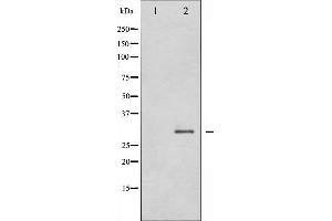 SNAIL antibody  (C-Term)