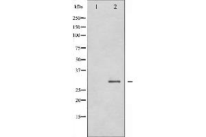Western blot analysis of SNAI1 expression in HT29 whole cell lysates,The lane on the left is treated with the antigen-specific peptide.