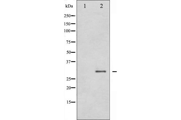 SNAIL antibody  (C-Term)