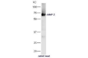 Rabbit heart lysates probed with Anti-MMP-2 Polyclonal Antibody, Unconjugated (ABIN707426) at 1:300 in 4˚C. (MMP2 antibody  (AA 401-500))