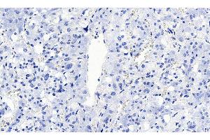 Immunohistochemistry (IHC) image for anti-Solute Carrier Family 18 (Vesicular Monoamine Transporter), Member 2 (SLC18A2) (C-Term) antibody (ABIN570915)