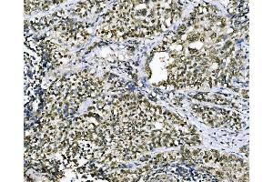 IHC analysis of CSNK2B using anti-CSNK2B antibody (ABIN7599092).