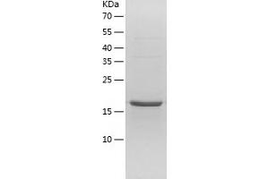 Western Blotting (WB) image for Cyclin-Dependent Kinase 5, Regulatory Subunit 1 (p35) (CDK5R1) (AA 1-160) protein (His tag) (ABIN7287269) (CDK5R1 Protein (AA 1-160) (His tag))