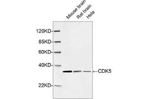Western blot analysis of cell and tissue lysates using 1 µg/mL Rabbit Anti-CDK5 Polyclonal Antibody (ABIN398921) The signal was developed with IRDyeTM 800 Conjugated Goat Anti-Rabbit IgG. (CDK5 antibody  (C-Term))