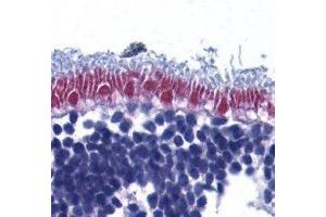 Immunohistochemistry (IHC) image for anti-Apoptosis-Inducing Factor, Mitochondrion-Associated, 1 (AIFM1) (AA 517-531) antibody (ABIN2477305) (AIF antibody  (AA 517-531))