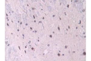 IHC-P analysis of Rat Spinal Cord Tissue, with DAB staining. (Endoglin antibody  (AA 26-136))