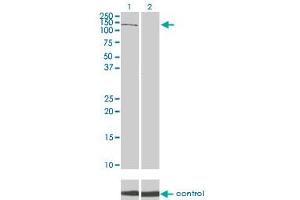 Western blot analysis of PIK3R4 over-expressed 293 cell line, cotransfected with PIK3R4 Validated Chimera RNAi (Lane 2) or non-transfected control (Lane 1). (PIK3R4 antibody  (AA 1259-1358))