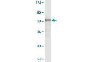 Western Blot detection against Immunogen (62. (AMBP antibody  (AA 19-352))