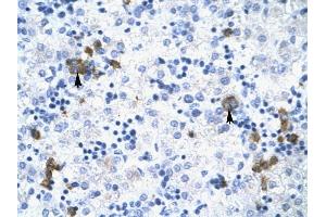 TRIM17 antibody was used for immunohistochemistry at a concentration of 4-8 ug/ml to stain Liver cells (arrows) in Human Liver.