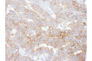 Immunohistochemistry (IHC) image for anti-Solute Carrier Family 9, Subfamily A (NHE3, Cation Proton Antiporter 3), Member 3 Regulator 1 (SLC9A3R1) (AA 325-358) antibody (ABIN7453744)