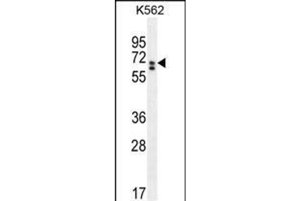 CLIP3 antibody  (C-Term)