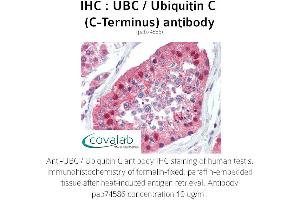 Image no. 2 for anti-Ubiquitin C (UBC) (C-Term) antibody (ABIN2852400) (UBC antibody  (C-Term))
