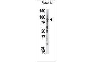 Abgent invites you to submit your data (IHC, IF, IP, WB, FC) using this product. (PTPRE antibody  (C-Term))