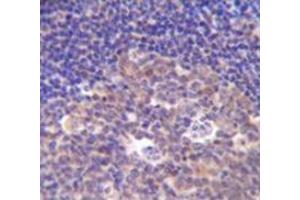 Immunohistochemistry analysis in human tonsil tissue (Formalin-fixed, Paraffin-embedded) using PIK3R5  Antibody  (C-term), followed by peroxidase conjugated secondary antibody and DAB staining. (PIK3R5 antibody  (C-Term))