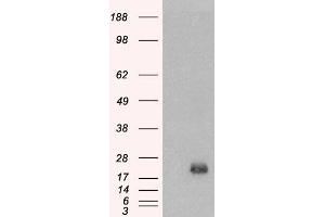 Western Blotting (WB) image for anti-Brain and Acute Leukemia, Cytoplasmic (BAALC) antibody (ABIN5858423)
