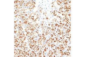 Immunohistochemistry of paraffin-embedded rat ovary using KLHL9 antibody (ABIN6132083, ABIN6142940, ABIN6142941 and ABIN6214299) at dilution of 1:100 (40x lens). (KLHL9 antibody  (AA 1-100))