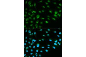 Immunofluorescence analysis of HeLa cell using MCM7 antibody. (MCM7 antibody  (AA 360-719))
