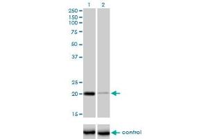 Western blot analysis of CETN3 over-expressed 293 cell line, cotransfected with CETN3 Validated Chimera RNAi (Lane 2) or non-transfected control (Lane 1). (CETN3 antibody  (AA 1-100))