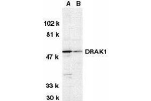 Western blot analysis of DRAK1 in (A) MOLT4 and (B) A431 whole cell lysates with DRAK1 antibody at 1μg/ml. (STK17A antibody  (AA 5-19))