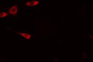 ABIN6274818 staining HeLa cells by IF/ICC. (ARFGAP1 antibody  (Internal Region))