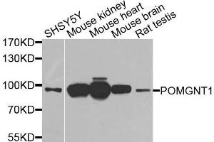 Western blot analysis of extracts of various cells, using POMGNT1 antibody.