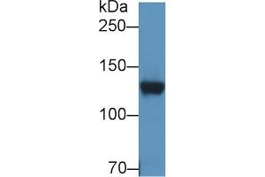 Detection of DPP6 in Rat Cerebrum lysate using Polyclonal Antibody to Dipeptidyl Peptidase 6 (DPP6) (DPP6 antibody  (AA 667-865))