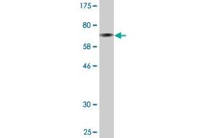 Western Blot detection against Immunogen (74. (GDI1 antibody  (AA 1-447))
