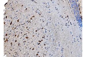 IHC analysis of GABARAP using anti-GABARAP antibody (ABIN7603159). (GABARAP antibody  (N-Term))