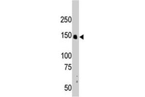 The CRKRS polyclonal antibody  is used in Western blot to detect CRKRS in mouse liver tissue lysate. (CDK12 antibody  (N-Term))