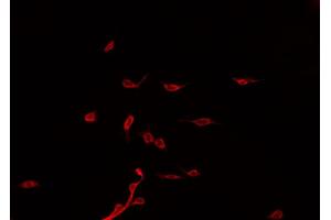 ABIN6275090 staining Hela by IF/ICC. (PJA2 antibody)