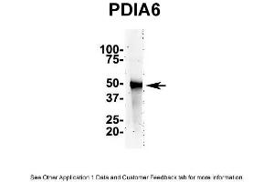IP Suggested AntiPDIA6 Antibody Positive Control: NT2 CELL/BRAIN TISSUE (PDIA6 antibody  (N-Term))